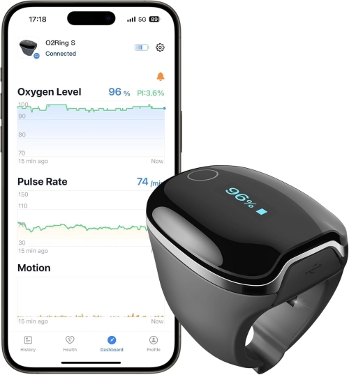 Pulsoximetru Wellue O2Ring-S tip inel, monitorizare SpO2 și puls, alertă prin vibrații, Bluetooth, negru, S