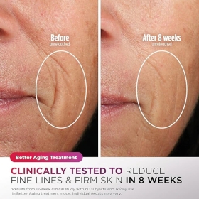 Shark FW312EUPL CryoGlow – masca faciala LED, cu lumina rosie/albastra si infrarosu, telecomanda